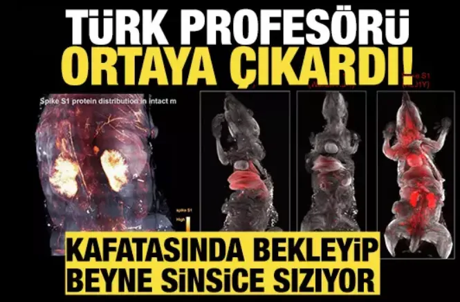 Türk profesörü ortaya çıkardı! Beyinde sinsice ilerliyor