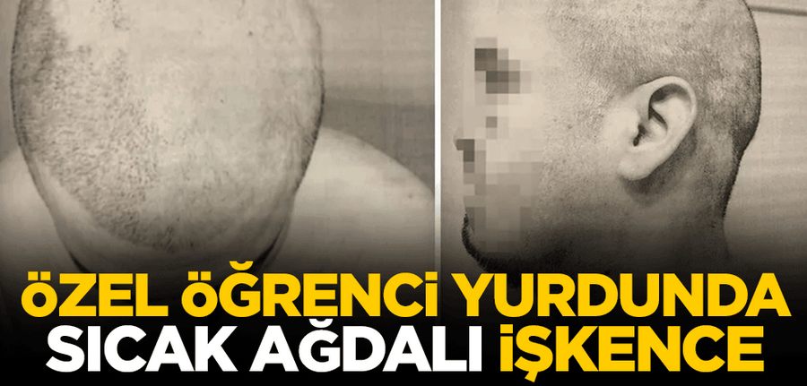 Özel ögrenci yurdunda sicak agdali iki saatlik iskence!