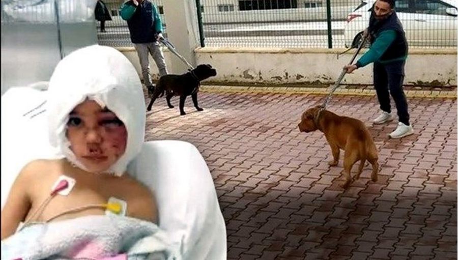 Pitbull saldirisina ugrayan Asiye için kritik saatler! Doku nakli operasyonu basladi, gözler gelecek güzel haberde